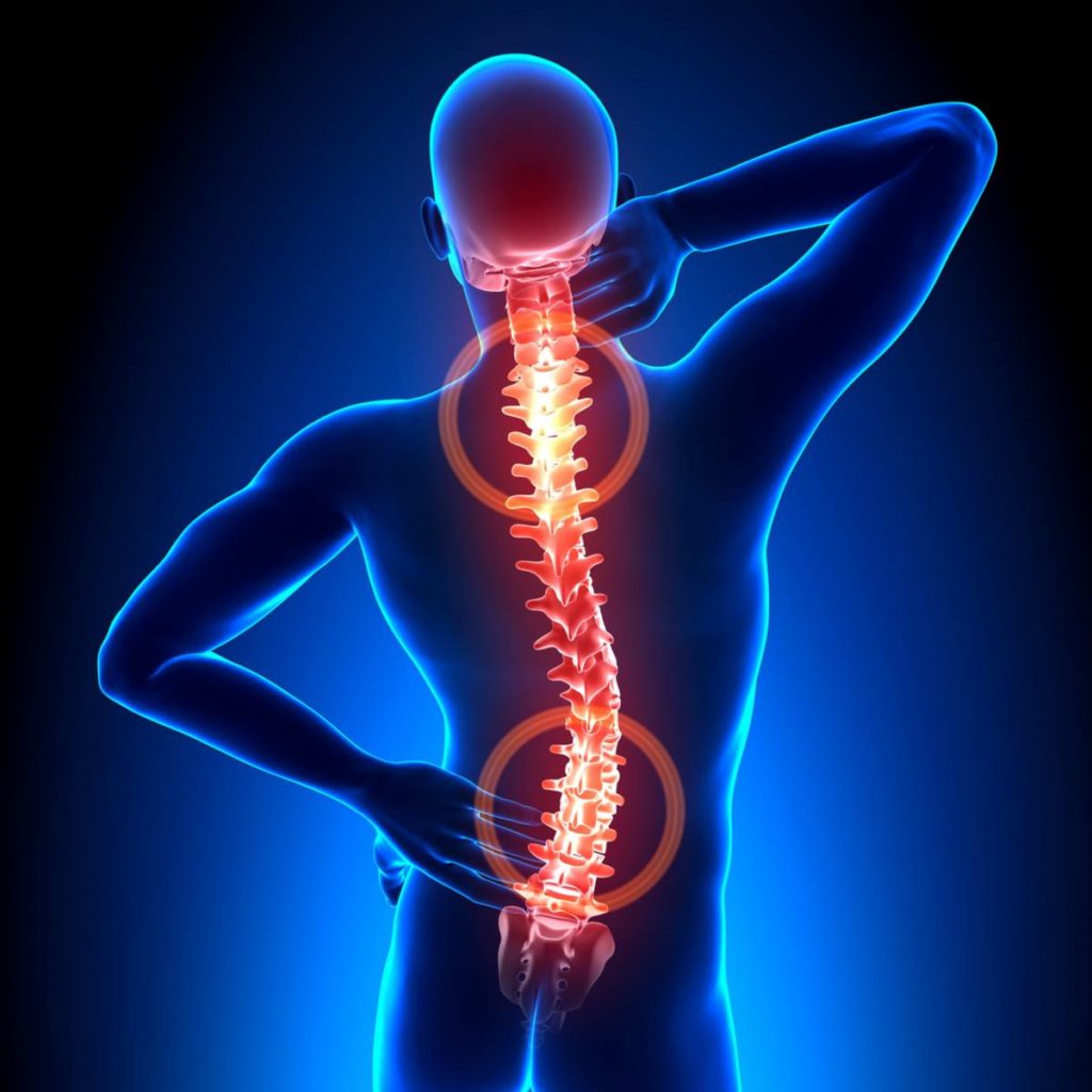 spine diseases